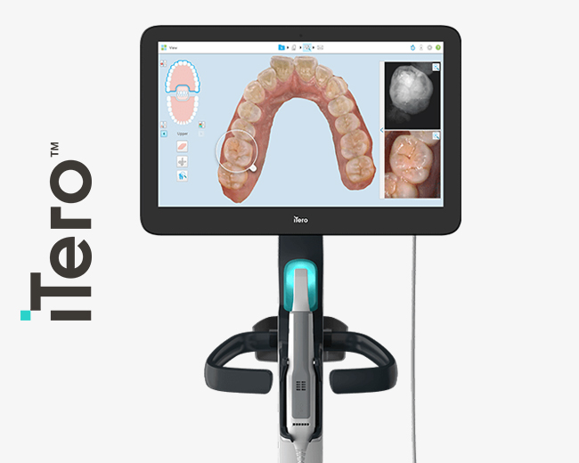 Tero digital orthodontic scanner displaying 3D dental arch model and intraoral images on screen.