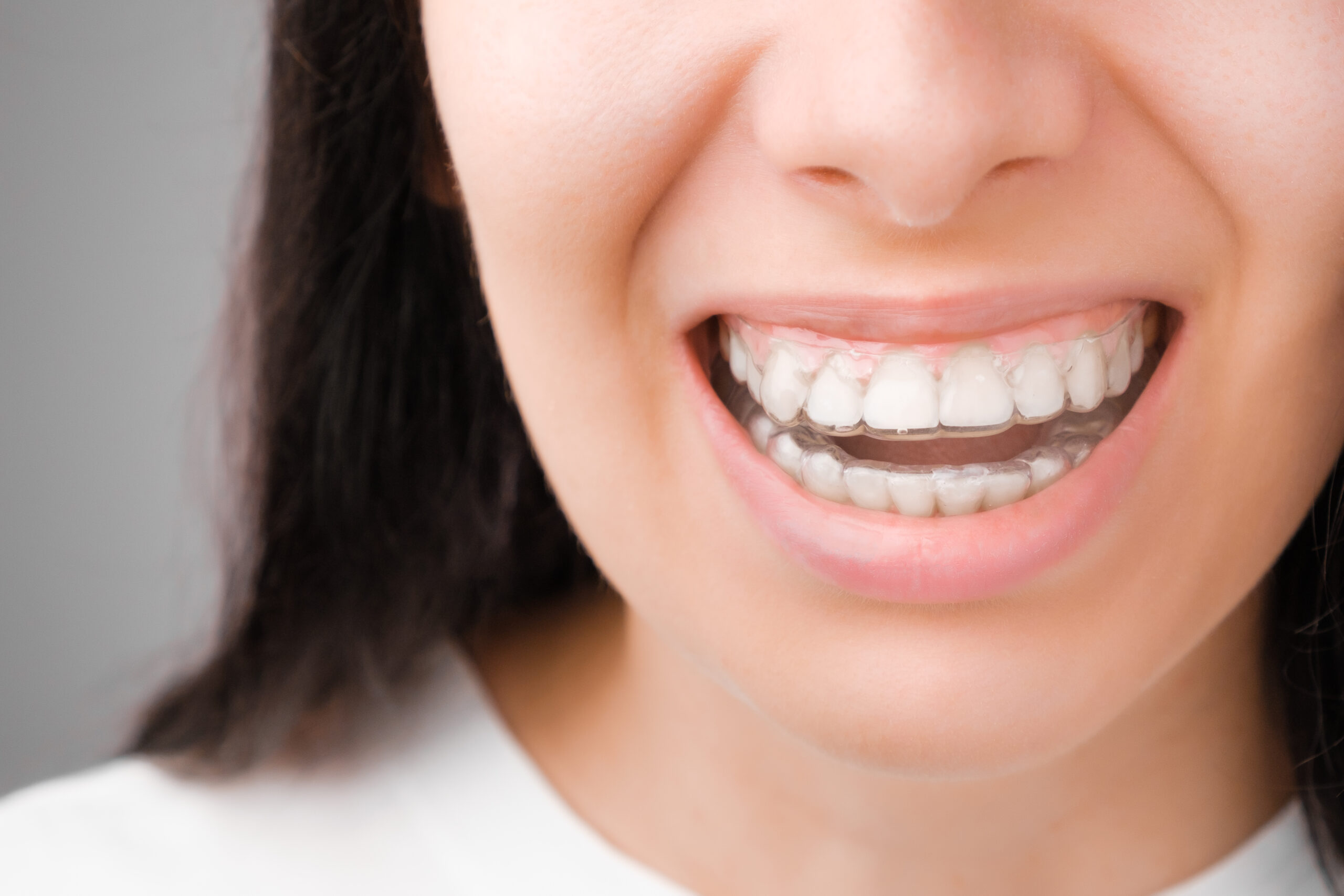 Woman smiling broadly displaying white, straight teeth against neutral gray background.